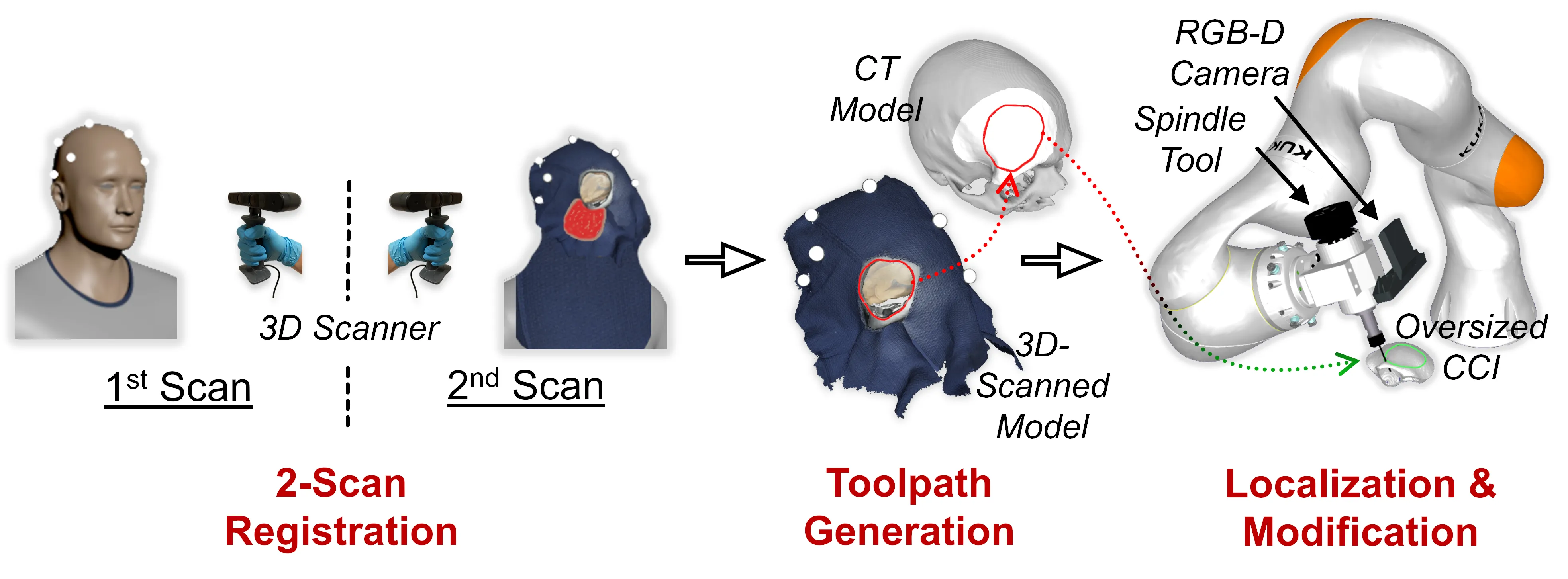 Automated Implant Modification in Neuroplastic Surgery