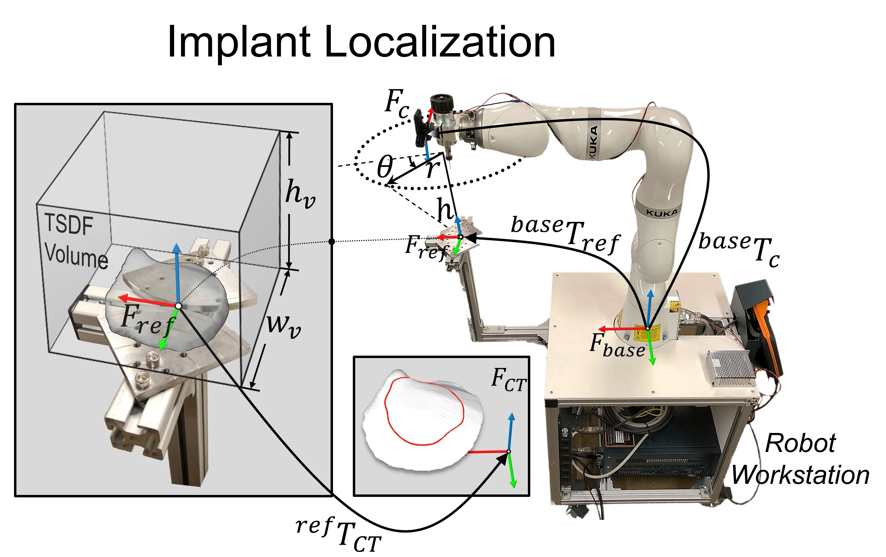 Automated Implant Modification in Neuroplastic Surgery