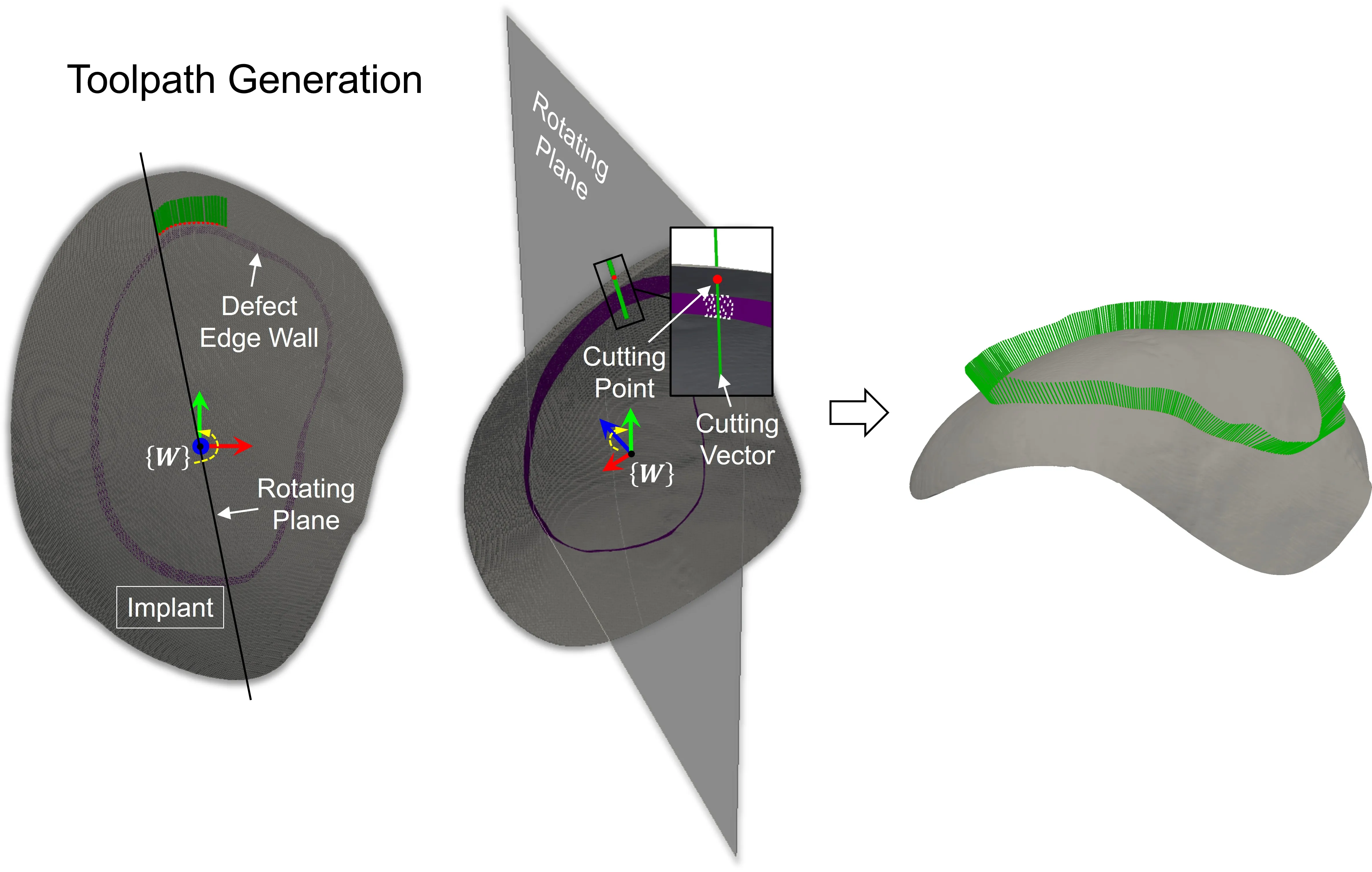 5-Axis Laser Cutting System for Cranial Implants Modification