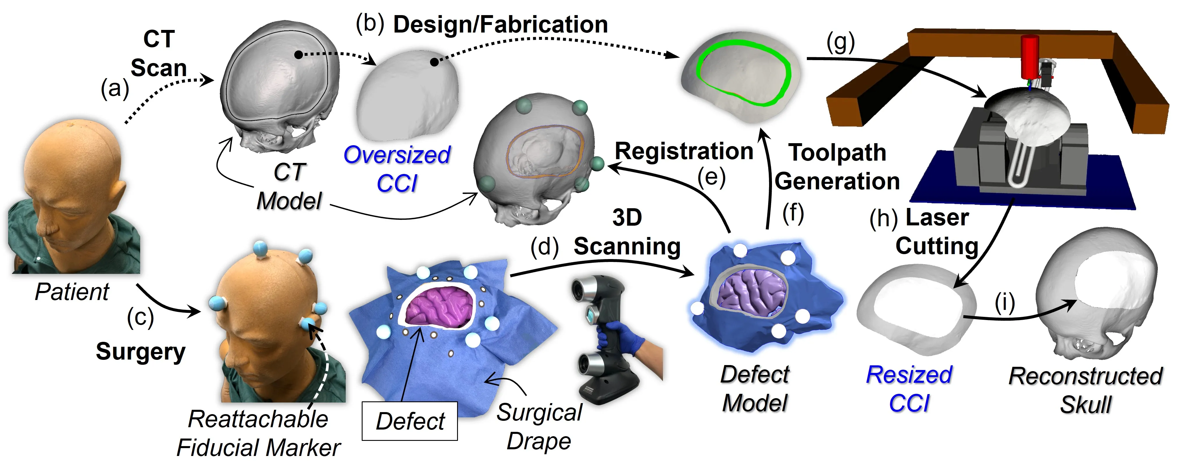 5-Axis Laser Cutting System for Cranial Implants Modification